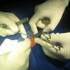 Neonatal surgery general